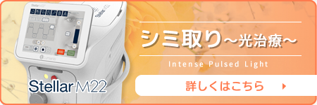 シミ取り（光治療）・ステラM22